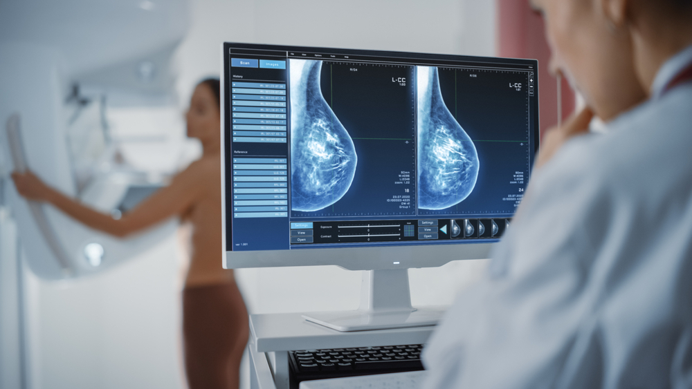 Mammographie et Tomosynthèse Mammaire